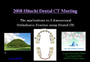 HITACHI　CBCT Meeting in Tokyo